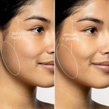 Dermaplaning