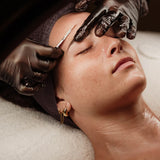 Dermaplaning